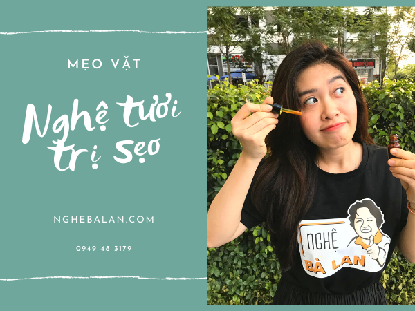 voh-uong-nghe-tuoi-voh.com.vn-1