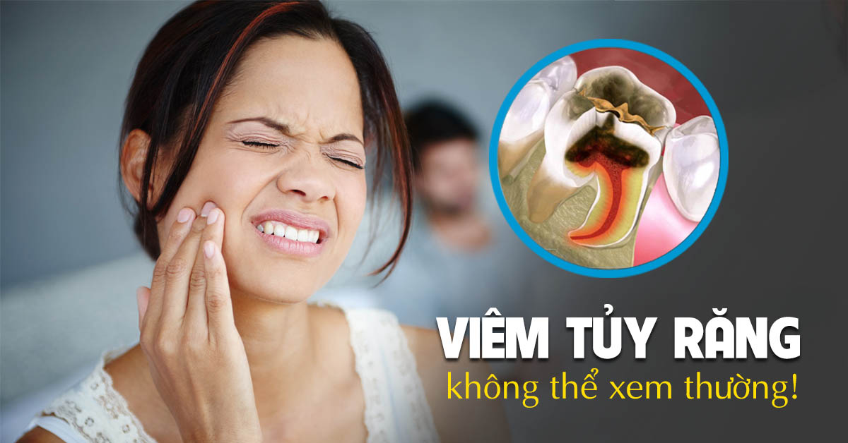 Viêm tủy răng: Dấu hiệu nhận biết, nguyên nhân và cách điều trị